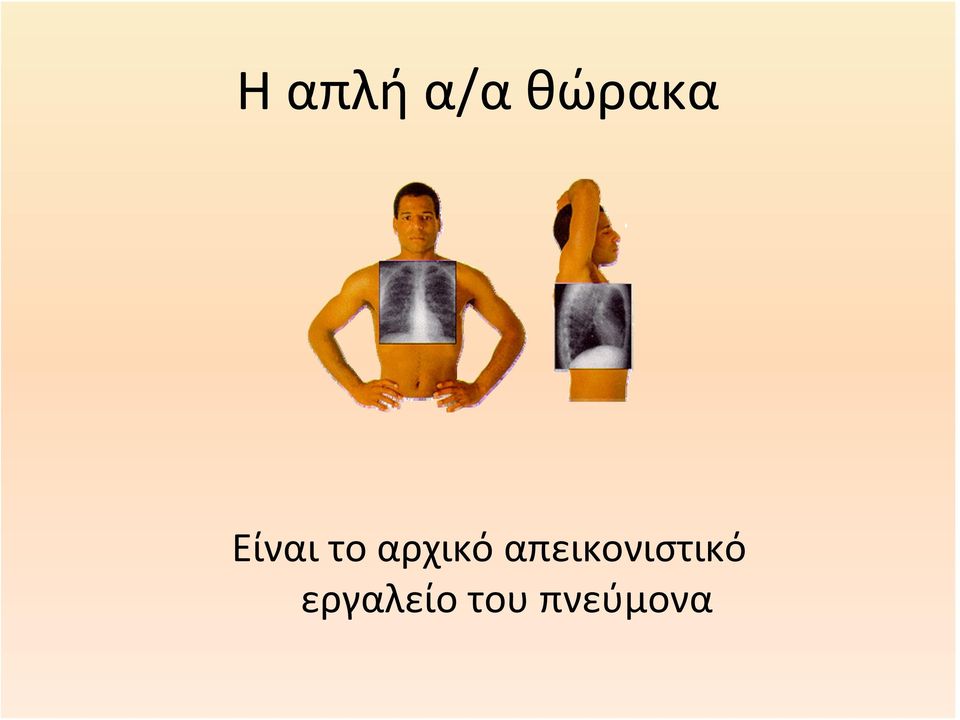απεικονιστικό