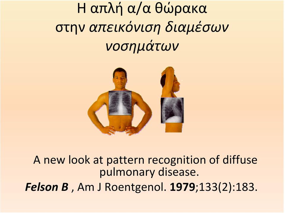 pattern recognition of diffuse
