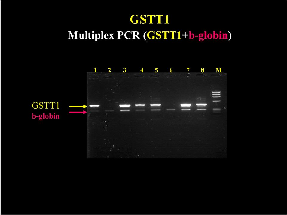 (GSTT1+b-globin)