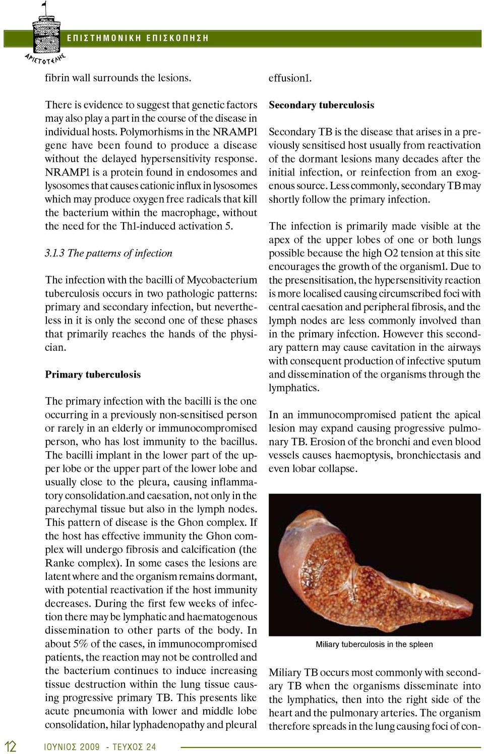 NRAMP1 is a protein found in endosomes and lysosomes that causes cationic influx in lysosomes which may produce oxygen free radicals that kill the bacterium within the macrophage, without the need