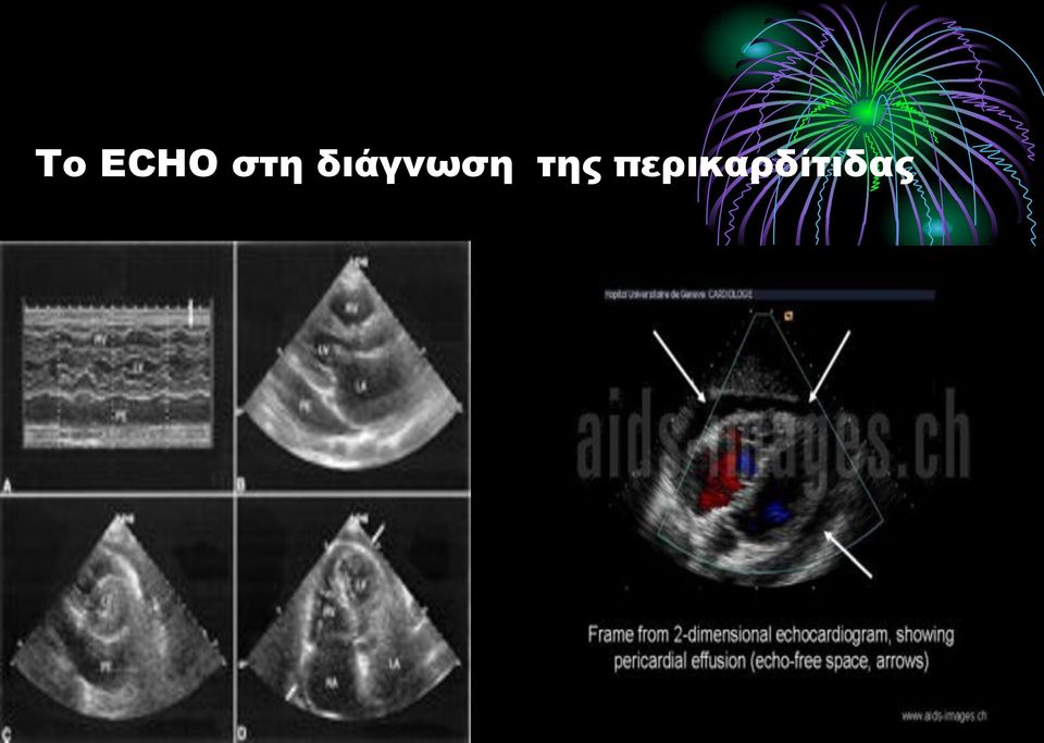 διάγνωση