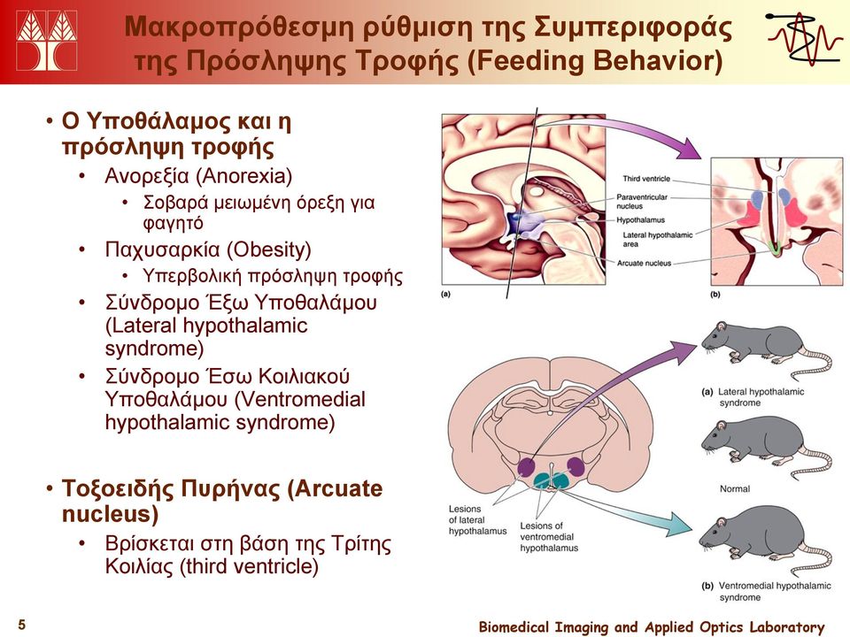 Σύνδρομο Έξω Υποθαλάμου (Lateral hypothalamic syndrome) Σύνδρομο Έσω Κοιλιακού Υποθαλάμου (Ventromedial