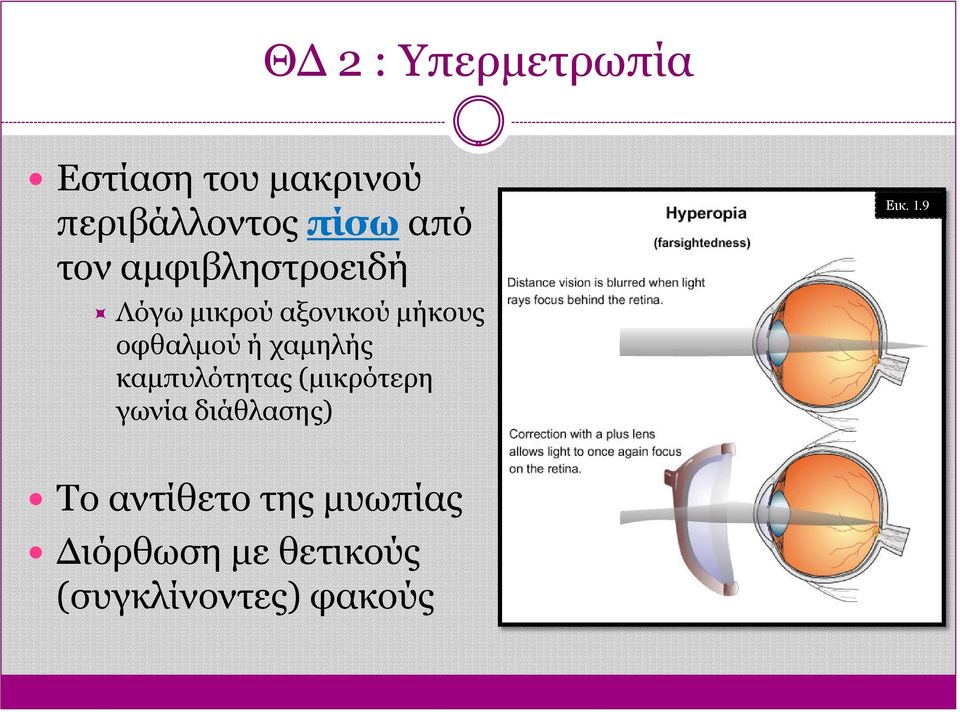 ή χαμηλής καμπυλότητας (μικρότερη γωνία διάθλασης) Εικ. 1.