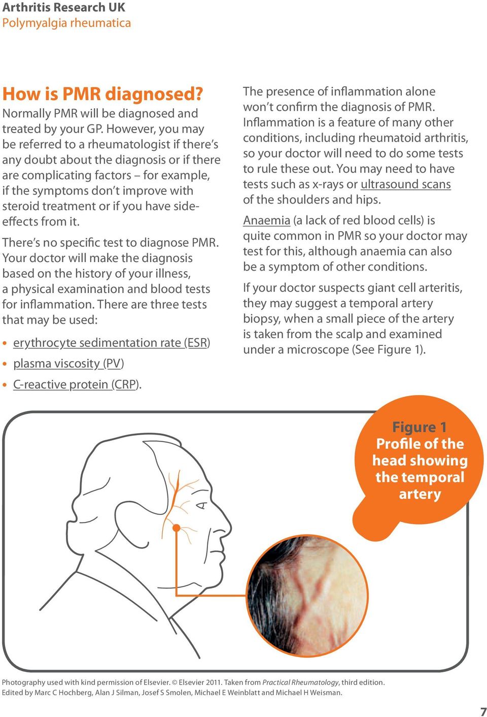 you have sideeffects from it. There s no specific test to diagnose PMR.