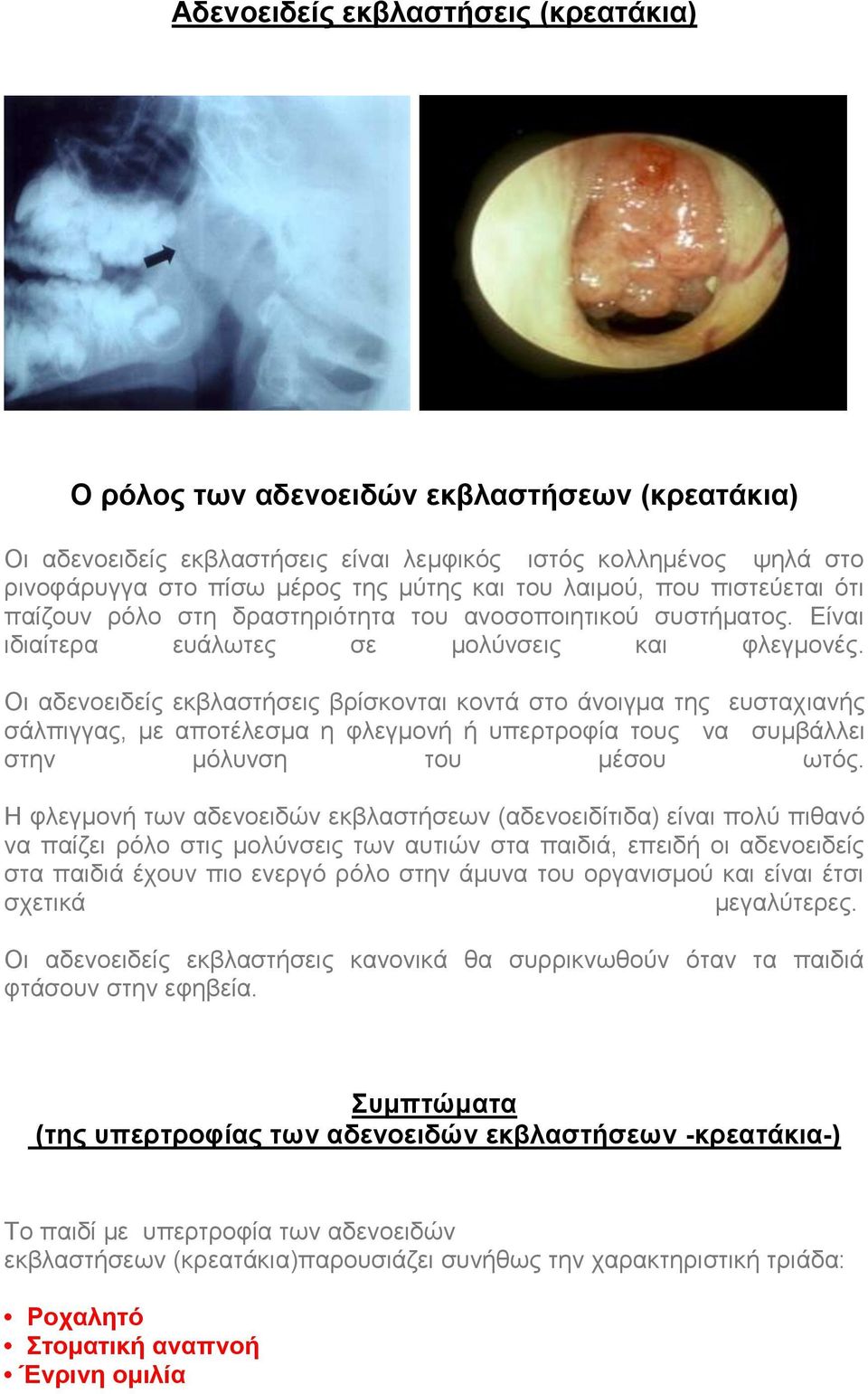 Οι αδενοειδείς εκβλαστήσεις βρίσκονται κοντά στο άνοιγμα της ευσταχιανής σάλπιγγας, με αποτέλεσμα η φλεγμονή ή υπερτροφία τους να συμβάλλει στην μόλυνση του μέσου ωτός.