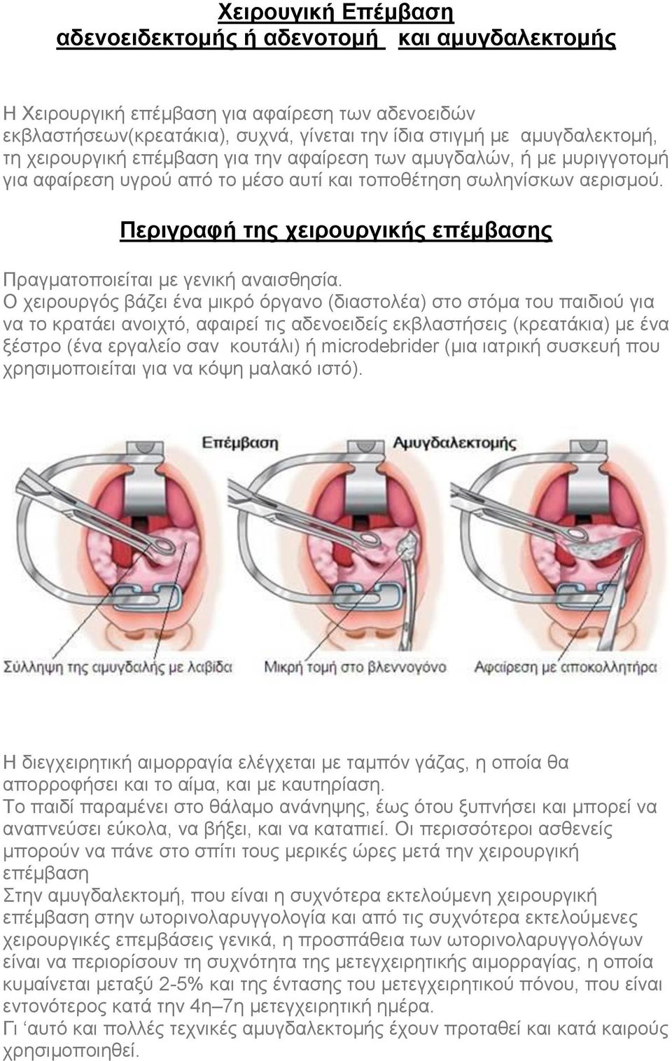 Περιγραφή της χειρουργικής επέμβασης Πραγματοποιείται με γενική αναισθησία.