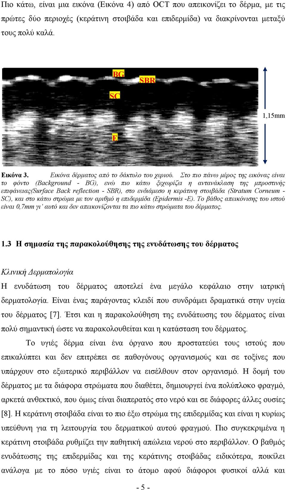 Στο πιο πάνω µέρος της εικόνας είναι το φόντο (Background - BG), ενώ πιο κάτω ξεχωρίζει η αντανάκλαση της µπροστινής επιφάνειας(surface Back reflection - SBR), στο ενδιάµεσο η κεράτινη στοιβάδα