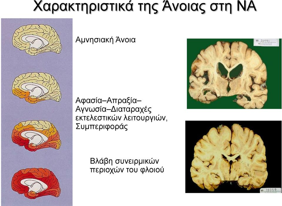 Διαταραχές εκτελεστικών λειτουργιών,