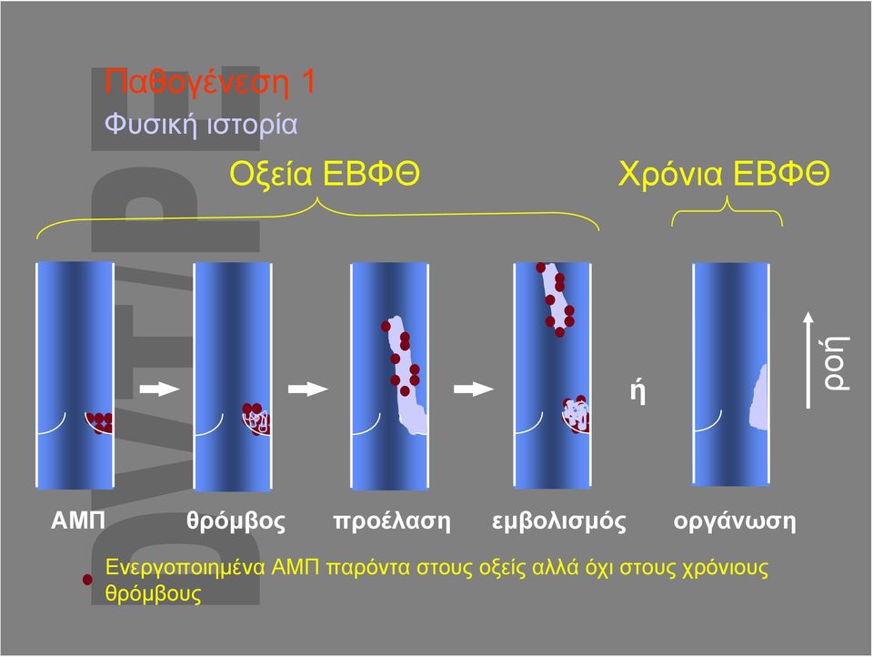 εμβολισμός οργάνωση Ενεργοποιημένα ΑΜΠ