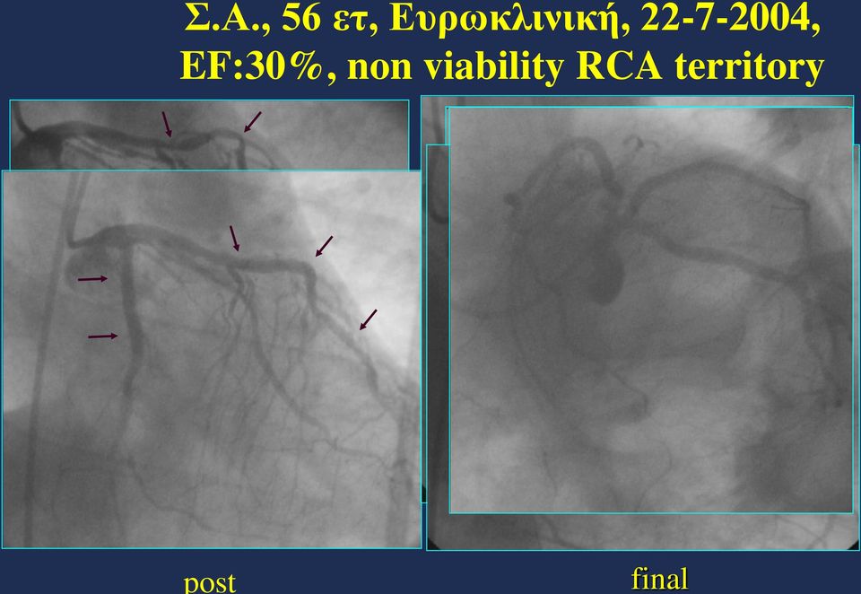 EF:30%, non viability