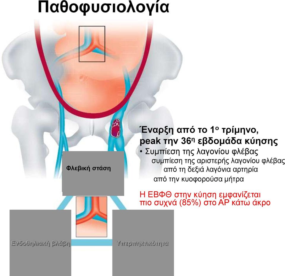 θιέβαο από ηε δεμηά ιαγόληα αξηεξία από ηελ θπνθνξνύζα κήηξα Η ΔΒΦΘ ζηελ