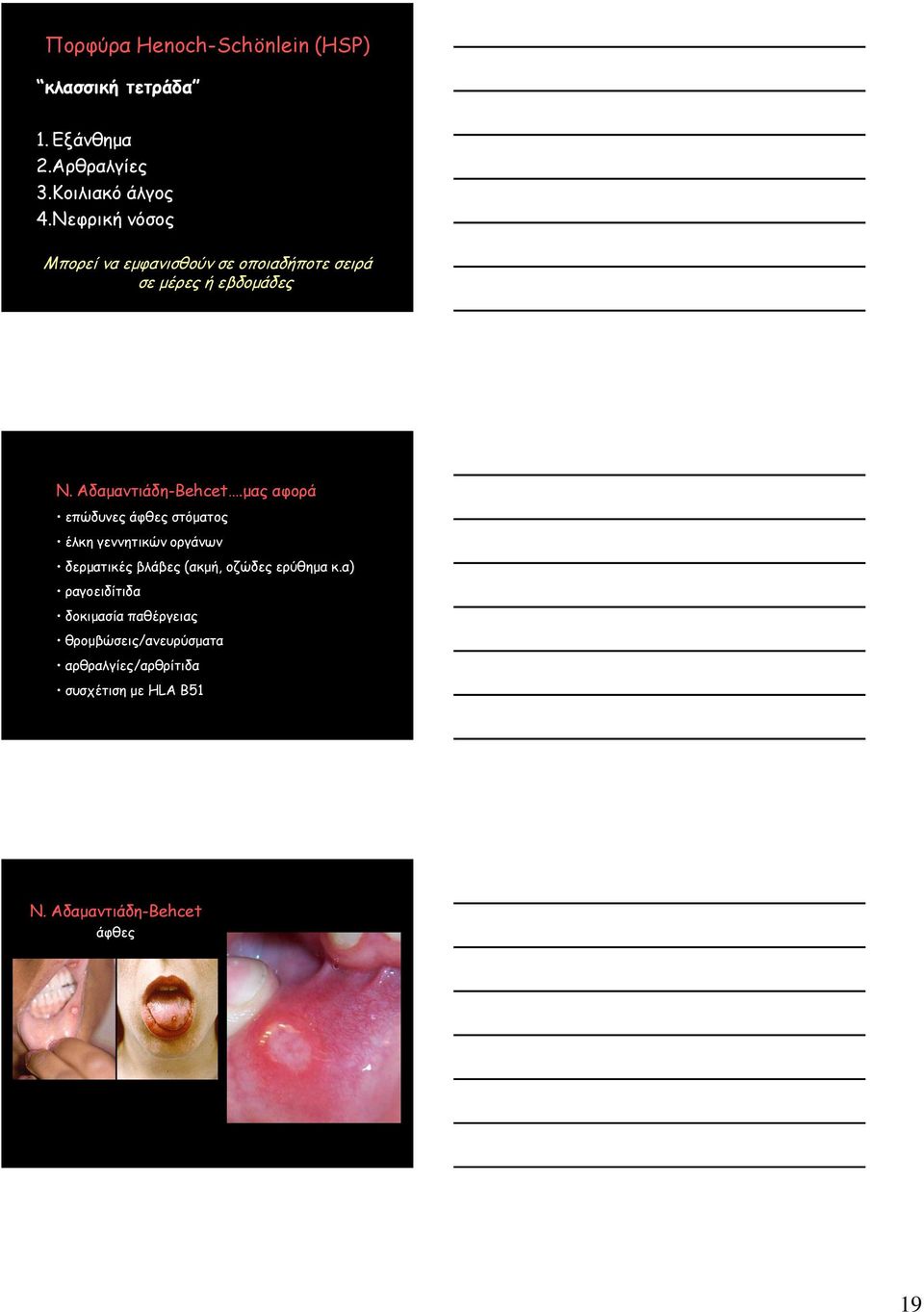 μας αφορά επώδυνες άφθες στόματος έλκη γεννητικών οργάνων δερματικές βλάβες (ακμή, οζώδες ερύθημα κ.