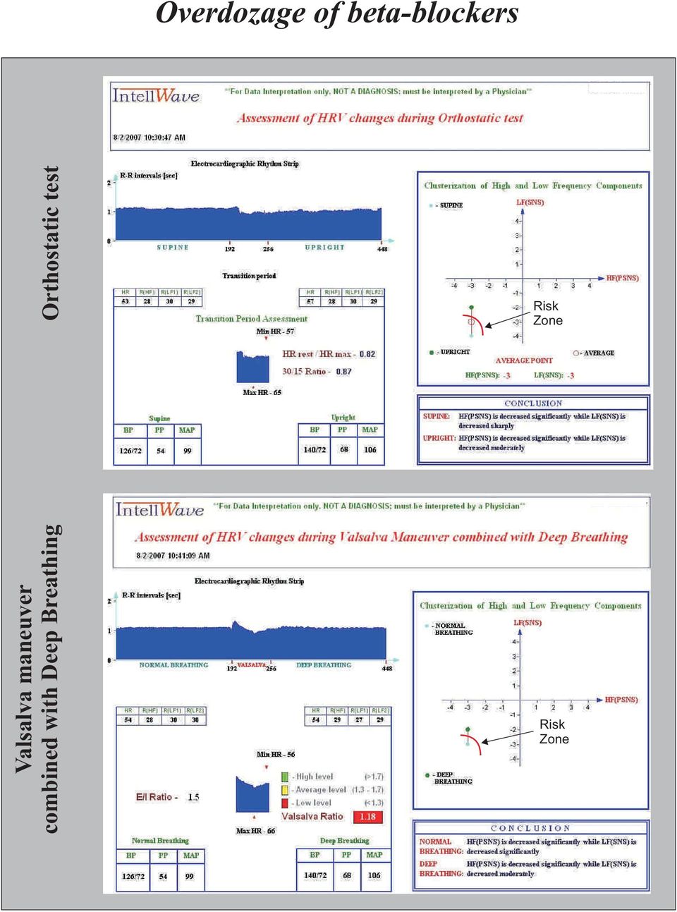 Valsalva maneuver combined