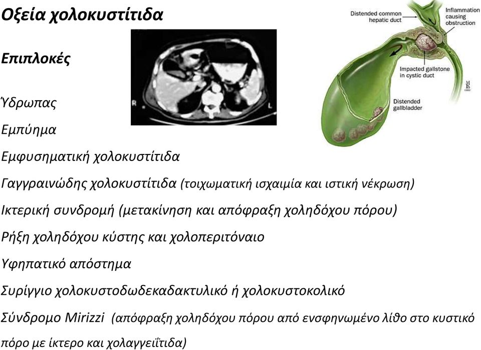 Ρήξη χοληδόχου κύστης και χολοπεριτόναιο Υφηπατικό απόστημα Συρίγγιο χολοκυστοδωδεκαδακτυλικό ή