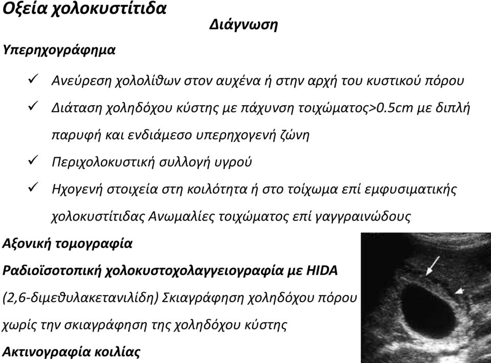 5cm με διπλή παρυφή και ενδιάμεσο υπερηχογενή ζώνη Περιχολοκυστική συλλογή υγρού Ηχογενή στοιχεία στη κοιλότητα ή στο τοίχωμα επί