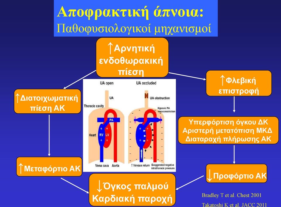 Αριστερή ετατόπιση ΜΚ ιαταραχή πλήρωσης ΑΚ Μεταφόρτιο ΑΚ Όγκος παλού