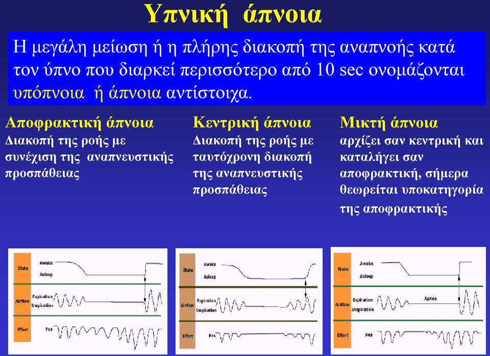 Αποφρακτική άπνοια ιακοπή της ροής ε συνέχιση της αναπνευστικής προσπάθειας Κεντρική άπνοια ιακοπή της