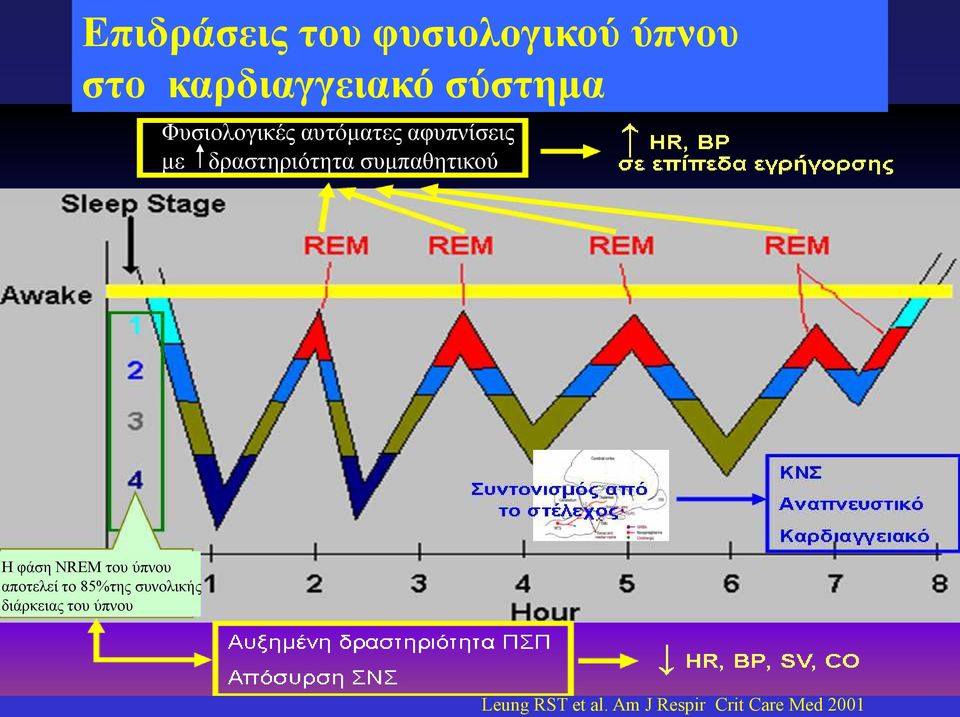 συπαθητικού Η φάση NREM του ύπνου αποτελεί το 85%της