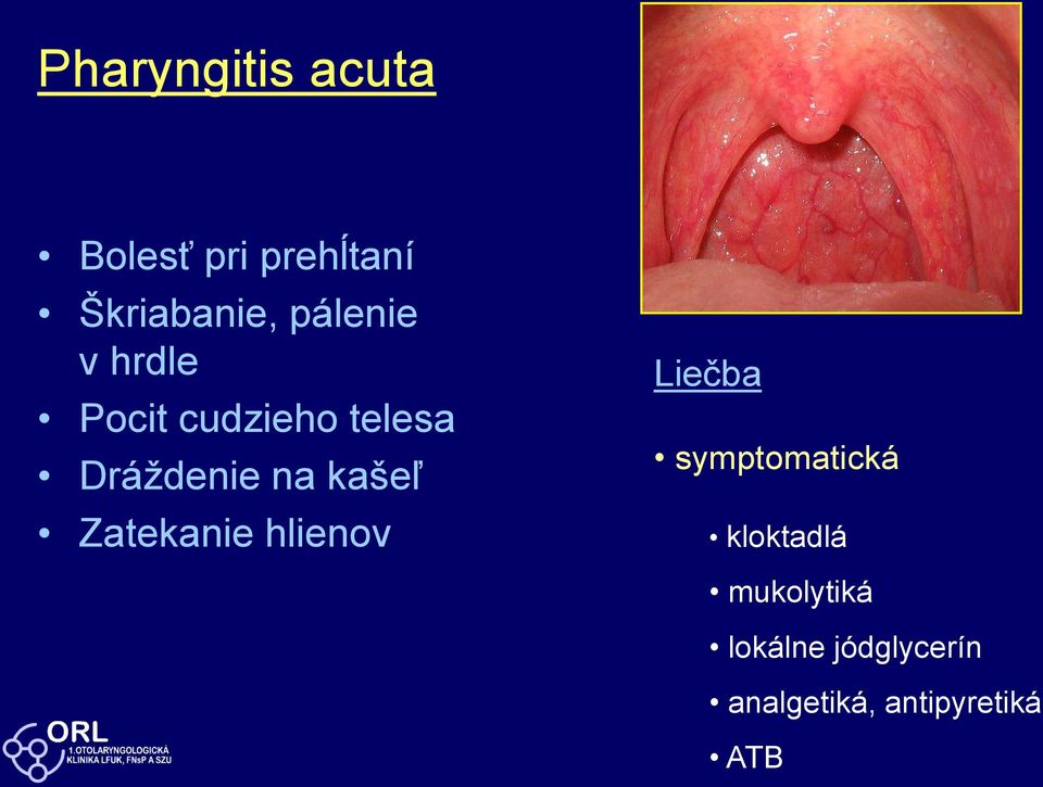 kašeľ Zatekanie hlienov Liečba symptomatická