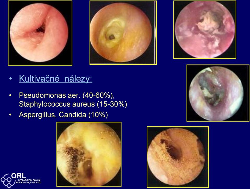 (40-60%), Staphylococcus