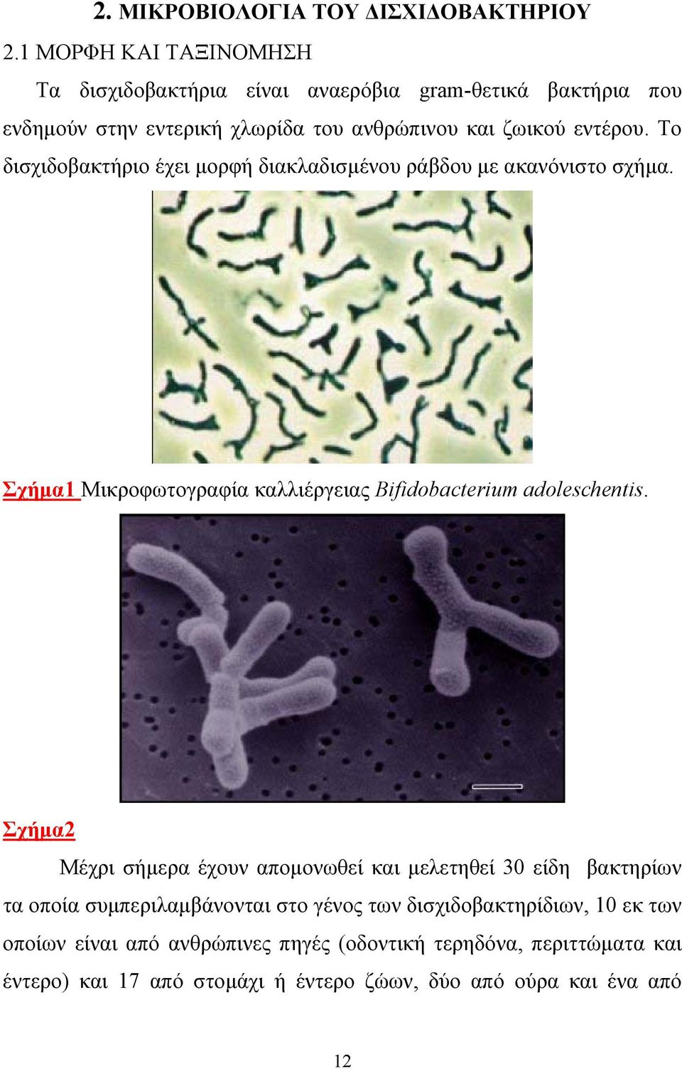 Το δισχιδοβακτήριο έχει µορφή διακλαδισµένου ράβδου µε ακανόνιστο σχήµα. Σχήµα1 Mικροφωτογραφία καλλιέργειας Bifidobacterium adoleschentis.