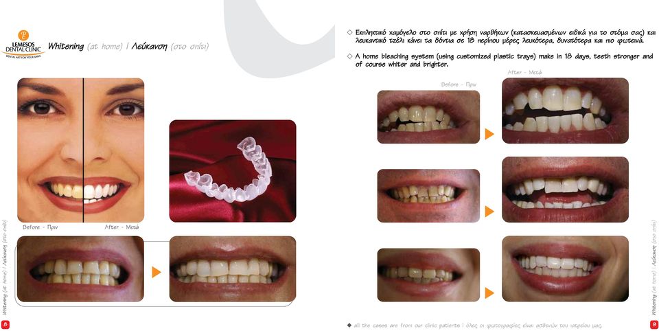 A home bleaching system (using customized plastic trays) make in 18 days, teeth stronger and of course whiter and brighter.