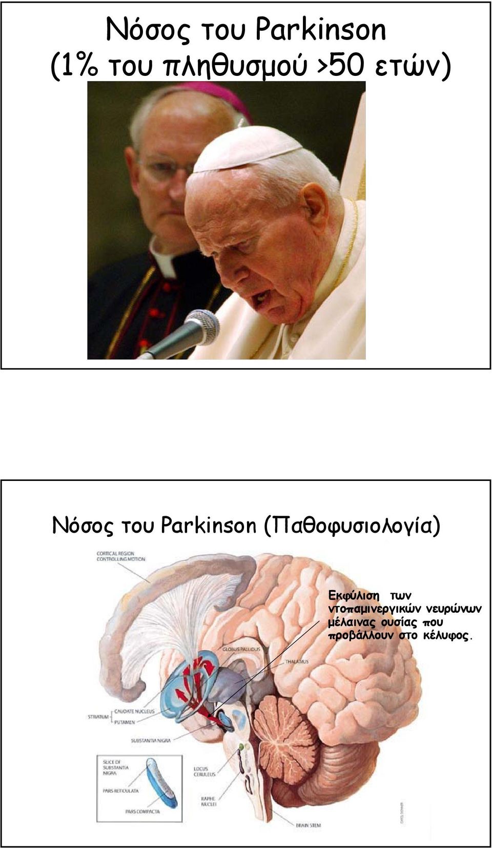 (Παθοφυσιολογία) Eκφύλιση των
