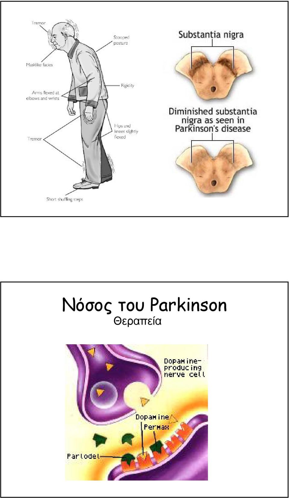 Θεραπεία