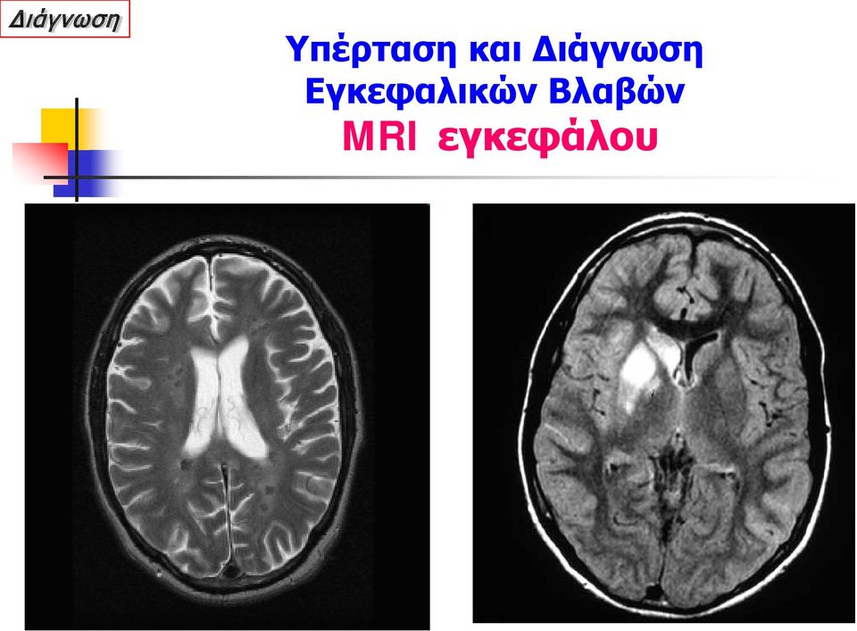 Εγκεφαλικών