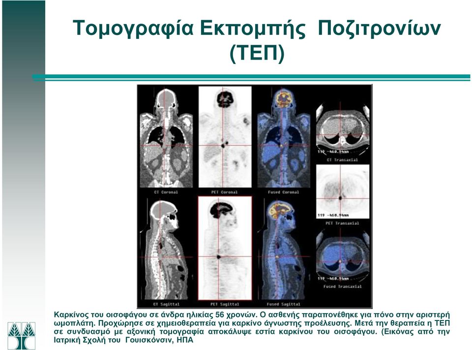 Προχώρησε σε χηµειοθεραπεία για καρκίνο άγνωστης προέλευσης.