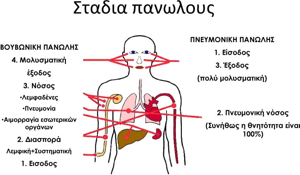 Διασπορά Λεμφική+Συστηματική 1. Εισοδος ΠΝΕΥΜΟΝΙΚΗ ΠΑΝΩΛΗΣ 1.