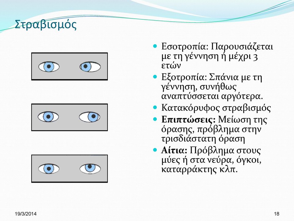 Κατακόρυφος στραβισμός Επιπτώσεις: Μείωση της όρασης, πρόβλημα στην