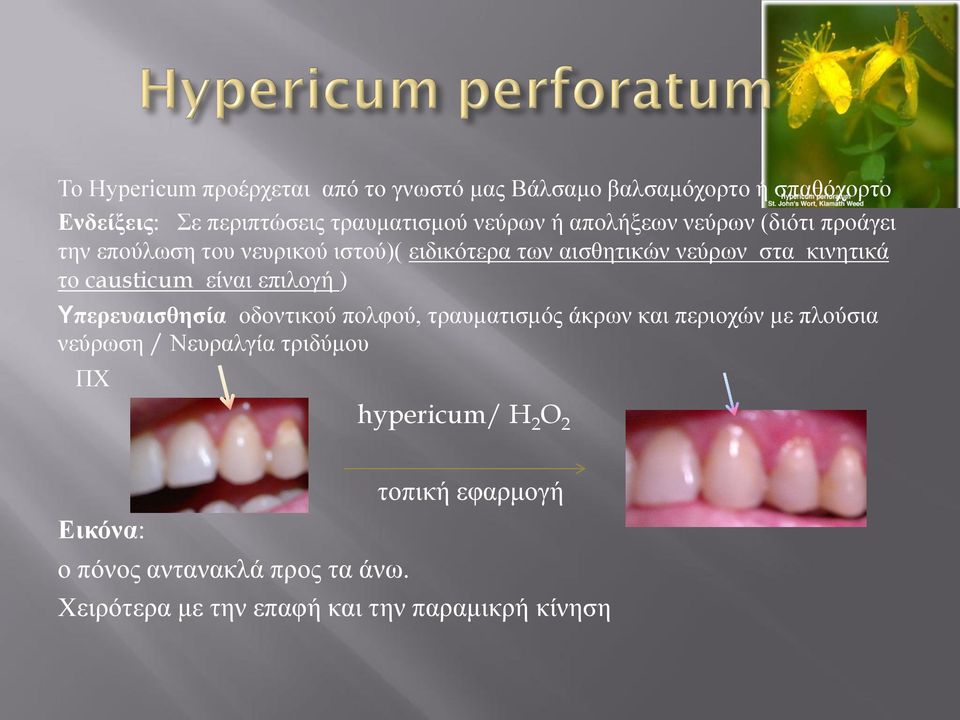 causticum είναι επιλογή ) Υπερευαισθησία οδοντικού πολφού, τραυματισμός άκρων και περιοχών με πλούσια νεύρωση / Νευραλγία