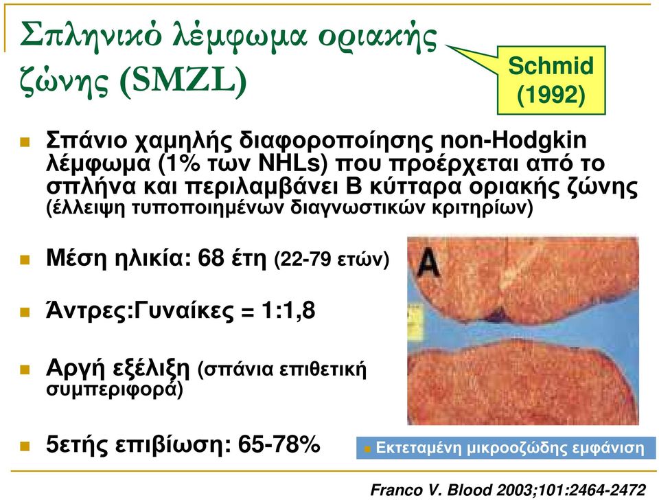διαγνωστικών κριτηρίων) Μέση ηλικία: 68 έτη (22-79 ετών) Άντρες:Γυναίκες = 1:1,8 Αργή εξέλιξη (σπάνια