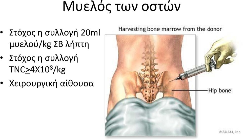 λήπτη Στόχος η συλλογή