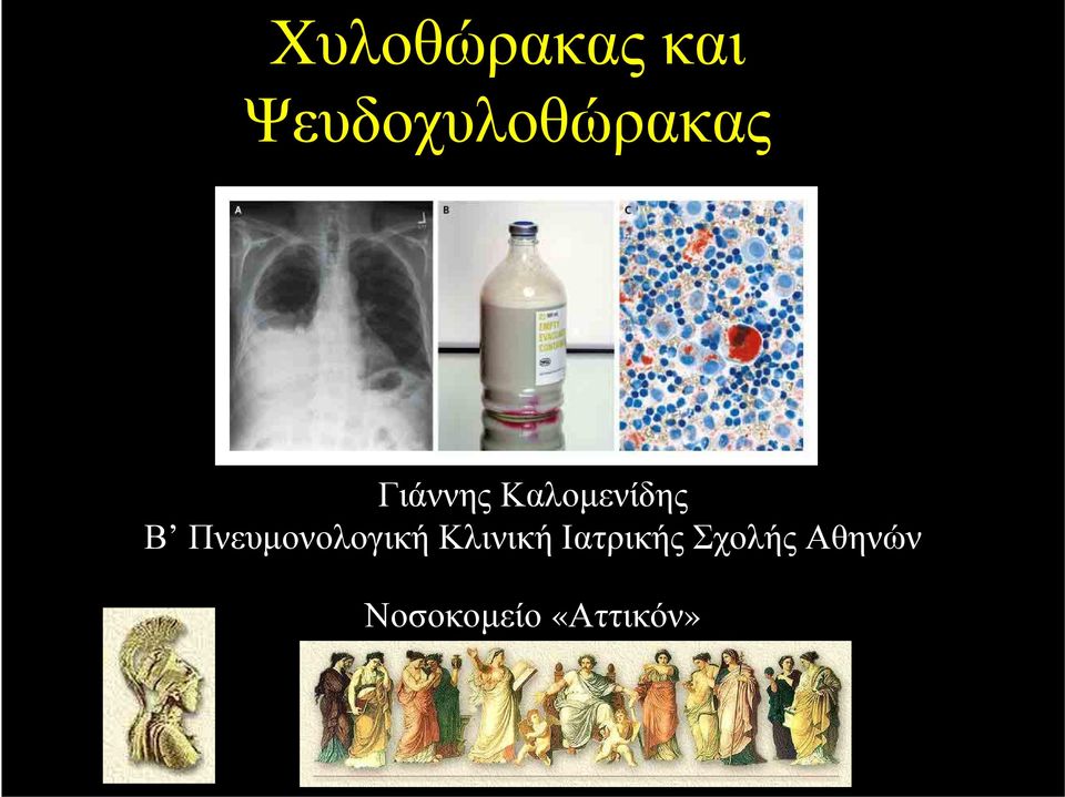 Καλομενίδης Β Πνευμονολογική