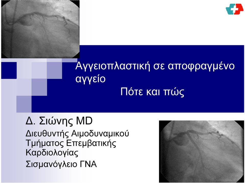 Σιώνης MD Διευθυντής Αιμοδυναμικού