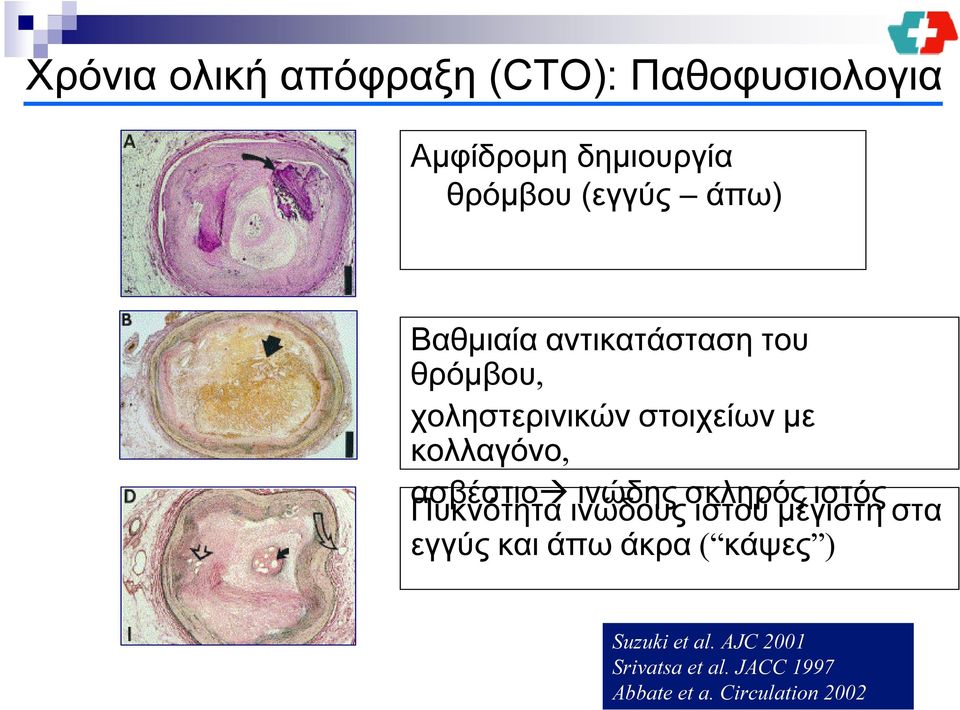 ασβέστιο ινώδης σκληρός ιστός Πυκνότητα ινώδους ιστού μέγιστη στα εγγύς και άπω