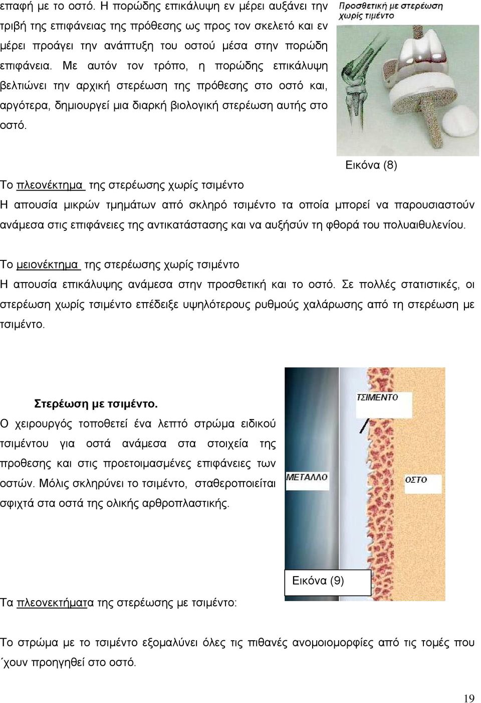 Εικόνα (8) Το πλεονέκτημα της στερέωσης χωρίς τσιμέντο Η απουσία μικρών τμημάτων από σκληρό τσιμέντο τα οποία μπορεί να παρουσιαστούν ανάμεσα στις επιφάνειες της αντικατάστασης και να αυξήσύν τη