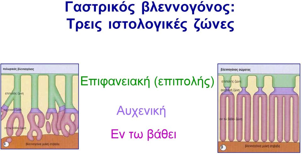 ζώνες Επιφανειακή