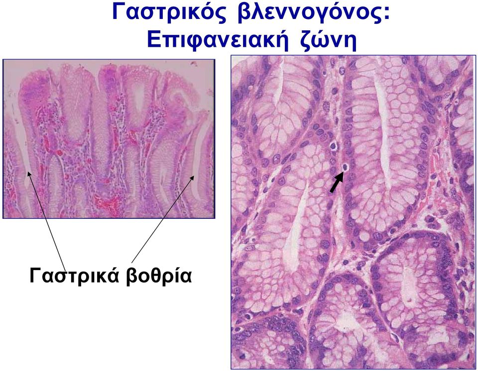 Επιφανειακή