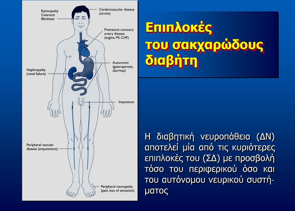 κυριότερες επιπλοκές του (ΣΔ) με προσβολή τόσο