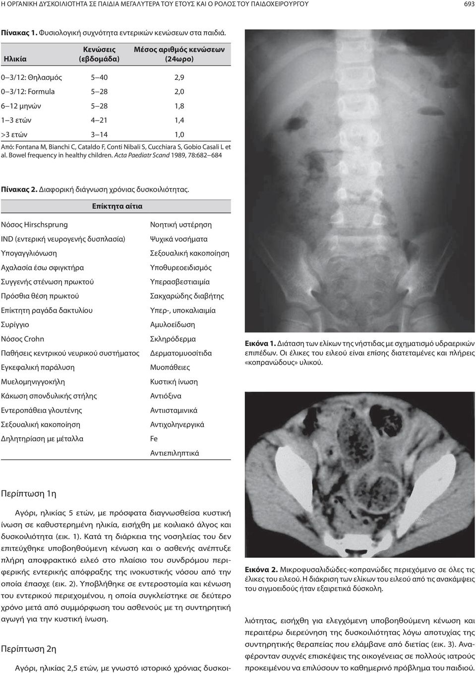 F, Conti Nibali S, Cucchiara S, Gobio Casali L et al. Bowel frequency in healthy children. Acta Paediatr Scand 1989, 78:682 684 Πίνακας 2. Διαφορική διάγνωση χρόνιας δυσκοιλιότητας.