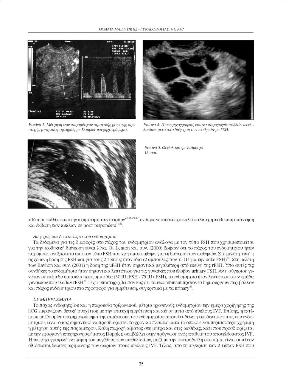 >16 mm, καθώς και στην ωριμότητα των ωαρίων 23-25,39,40, ενώ φαίνεται ότι προκαλεί καλύτερη ωοθηκική απάντηση και έκβαση των κύκλων σε poor responders 41,42.