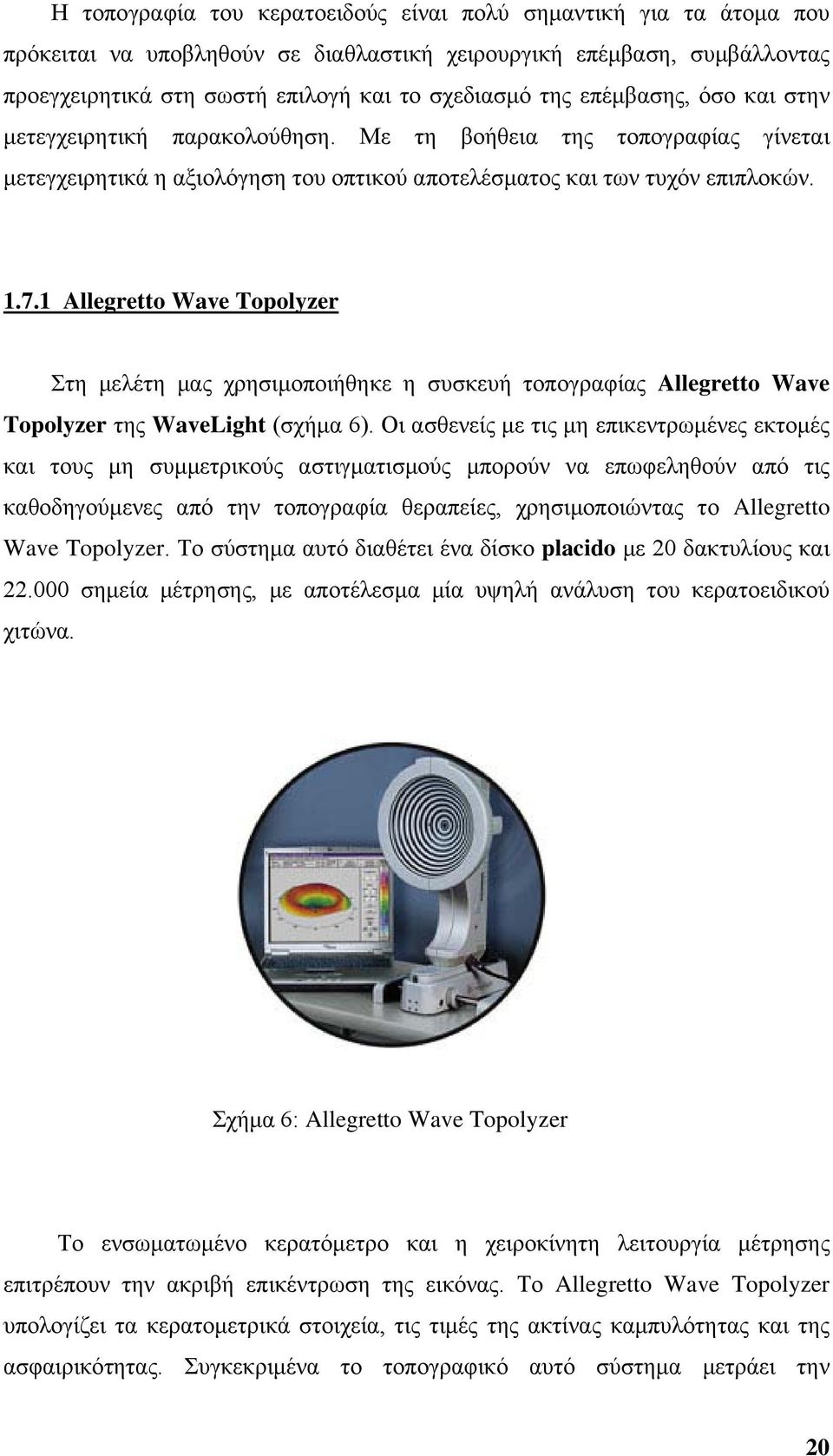 1 Allegretto Wave Topolyzer Στη μελέτη μας χρησιμοποιήθηκε η συσκευή τοπογραφίας Allegretto Wave Topolyzer της WaveLight (σχήμα 6).