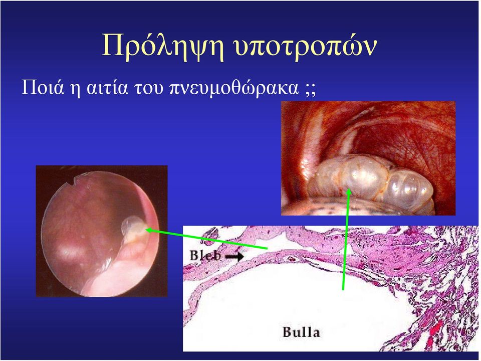 Ποιά η αιτία