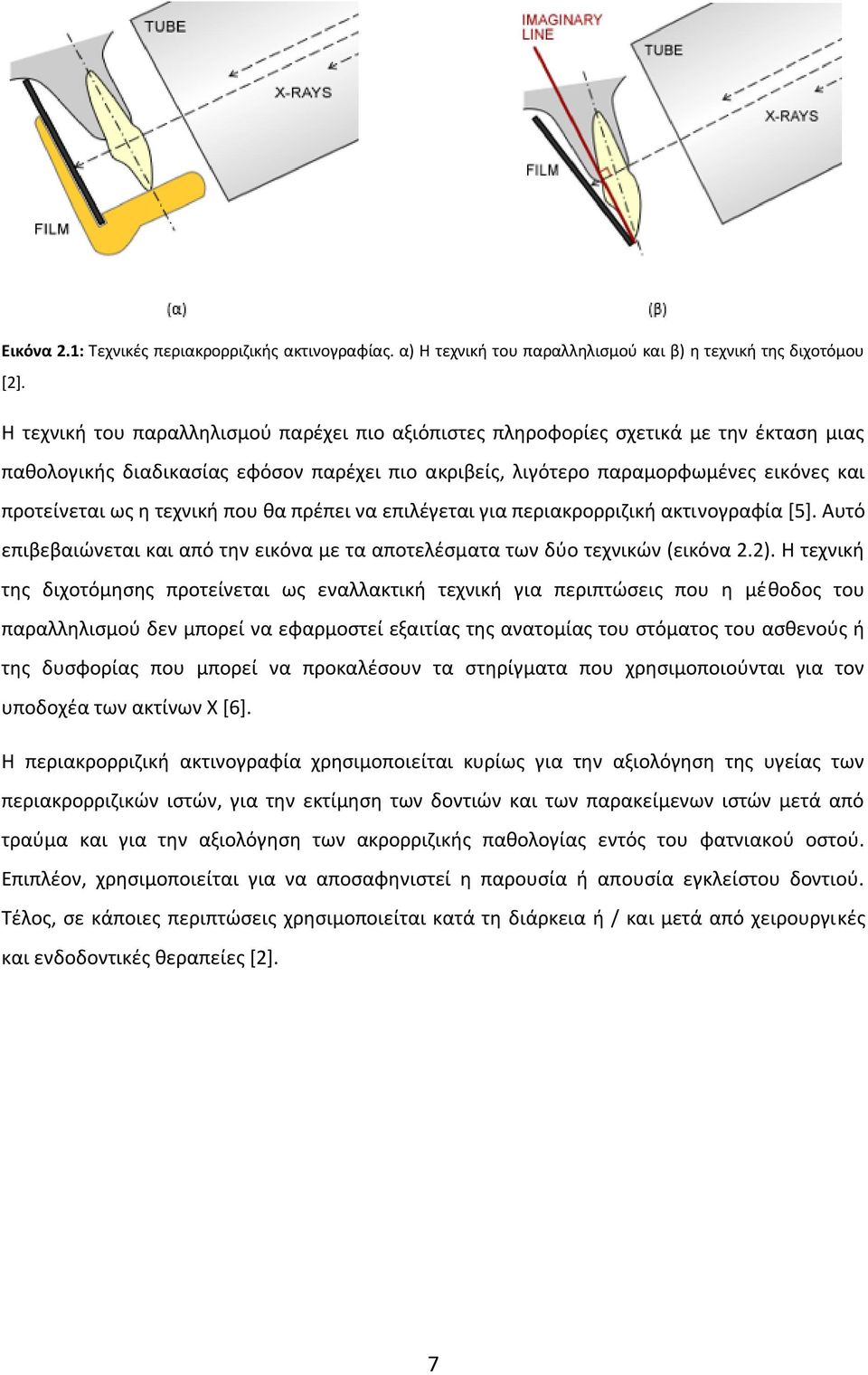 τεχνική που θα πρέπει να επιλέγεται για περιακρορριζική ακτινογραφία [5]. Αυτό επιβεβαιώνεται και από την εικόνα με τα αποτελέσματα των δύο τεχνικών (εικόνα 2.2).