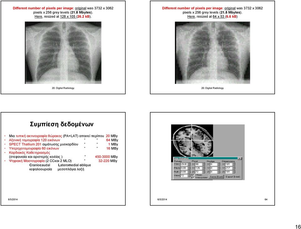 6 kb) 20: Digital Radiology 20: Digital Radiology Συμπίεση δεδομένων Μια τυπική ακτινογραφία θώρακος (PA+LAT) απαιτεί περίπου 20 MBy Αξονική τομογραφία 120 εικόνων 64 MBy SPECT