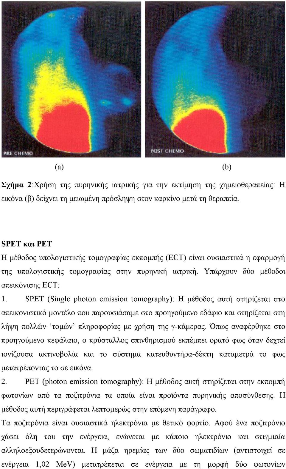 SPET (Single photon emission tomography): Η μέθοδος αυτή στηρίζεται στο απεικονιστικό μοντέλο που παρουσιάσαμε στο προηγούμενο εδάφιο και στηρίζεται στη λήψη πολλών τομών πληροφορίας με χρήση της