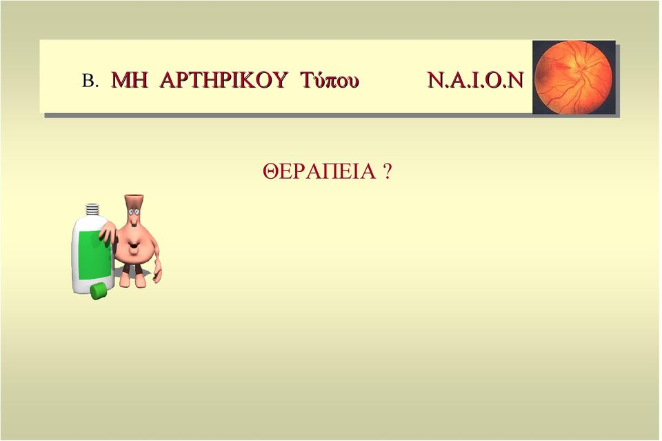 Τύπου Ν.Α.